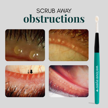 Load image into Gallery viewer, Eye care product with close-up images of eye issues and a cleaning tool labeled 'we love eyes'.