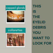 Load image into Gallery viewer, Stye Cleansing System