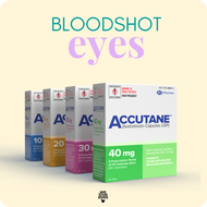 ACCUTANE eye redness  BLOODSHOT EYES on ACCUTANE  RED EYES treatment