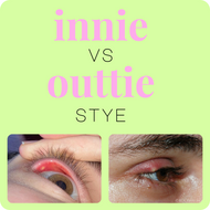 INNIE VS. OUTIE STYE  inner eyelid stye treatment  Stye Cleansing System  upper eyelid stye care  eyelid hygiene routine  posteror stye management  warm compress for stye  We Love Eyes STYE kit