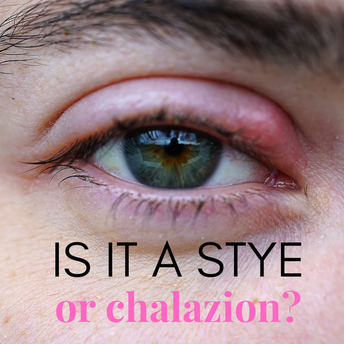 Stye vs. Chalazion: How to Identify and Treat Common Eyelid Bumps for Better Eye Health