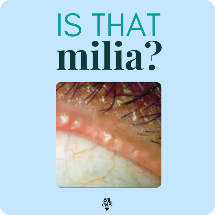 Can MILIA Occur on the Waterline? How to Decipher those White Pearly Dots