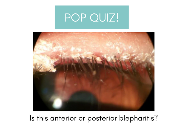 Anterior or Posterior? Pop quiz time!