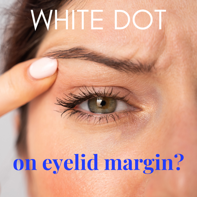 White Dot on Eyelid Margin: Common Causes and Expert Eye Care Tips from We Love Eyes