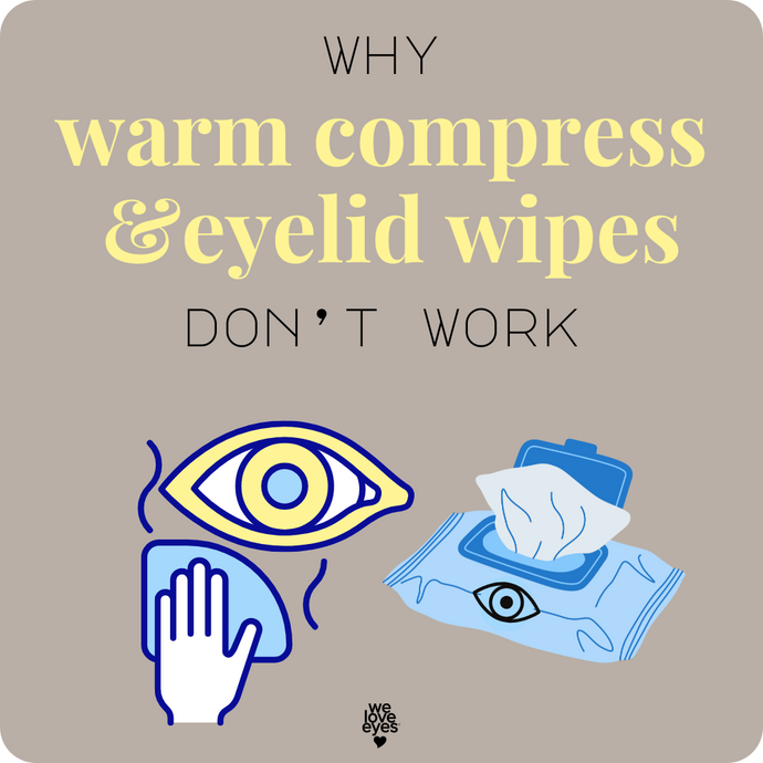 What To Do When Warm Compress & Eyelid Wipes Are No Help for Recurrent Innie Eyelid Styes